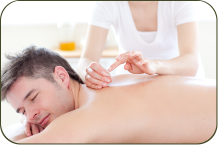 Men under acupuncture treatment